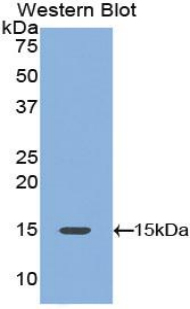 Polyclonal Antibody to Platelet Derived Growth Factor AA (PDGFAA)