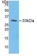 Polyclonal Antibody to Tissue Factor (TF)