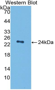 Polyclonal Antibody to Tissue Plasminogen Activator (tPA)