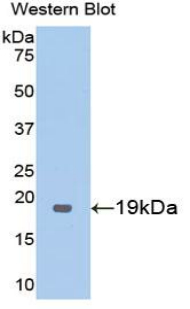 PAA529Hu01.jpg