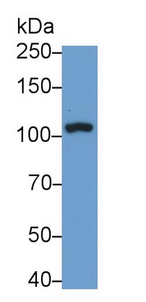 Polyclonal Antibody to Thrombomodulin (TM)