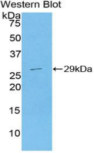 Polyclonal Antibody to Plasminogen Activator Inhibitor 2 (PAI2)