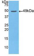 Polyclonal Antibody to Enolase, Neuron Specific (NSE)