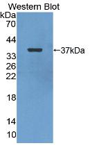 Polyclonal Antibody to Enolase, Neuron Specific (NSE)