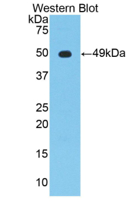 Polyclonal Antibody to Enolase, Neuron Specific (NSE)