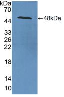 Polyclonal Antibody to Enolase, Neuron Specific (NSE)
