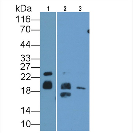 Polyclonal Antibody to Myelin Basic Protein (MBP)