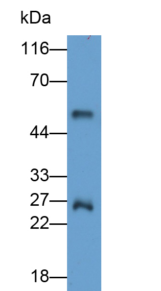 Polyclonal Antibody to Immunoglobulin G (IgG)