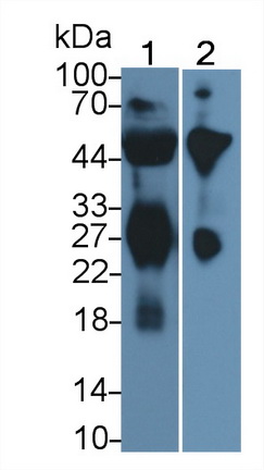 Polyclonal Antibody to Immunoglobulin A (IgA)