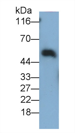 Polyclonal Antibody to Immunoglobulin A (IgA)