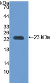 Polyclonal Antibody to Vascular Cell Adhesion Molecule 1 (VCAM1)