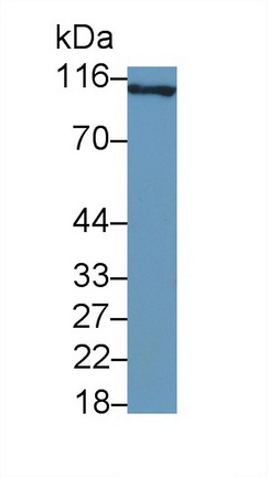 Polyclonal Antibody to Vascular Cell Adhesion Molecule 1 (VCAM1)