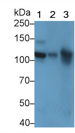 Polyclonal Antibody to Vascular Cell Adhesion Molecule 1 (VCAM1)