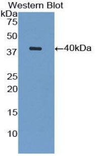 Polyclonal Antibody to Vascular Cell Adhesion Molecule 1 (VCAM1)