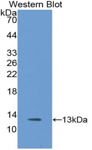 Polyclonal Antibody to Vascular Cell Adhesion Molecule 1 (VCAM1)