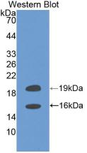 Polyclonal Antibody to Fibroblast Growth Factor 2, Basic (FGF2)