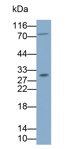 Polyclonal Antibody to Tissue Inhibitors Of Metalloproteinase 1 (TIMP1)