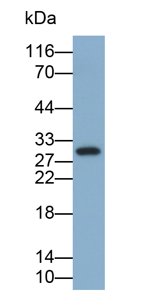 Polyclonal Antibody to Tissue Inhibitors Of Metalloproteinase 1 (TIMP1)