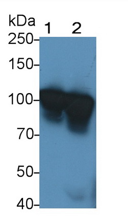 Polyclonal Antibody to Matrix Metalloproteinase 9 (MMP9)