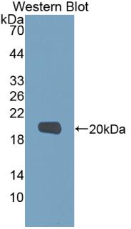 Polyclonal Antibody to Matrix Metalloproteinase 9 (MMP9)