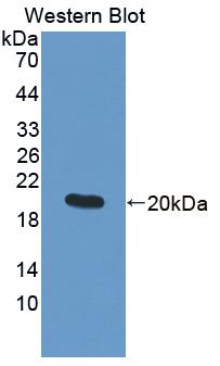 Polyclonal Antibody to Matrix Metalloproteinase 9 (MMP9)