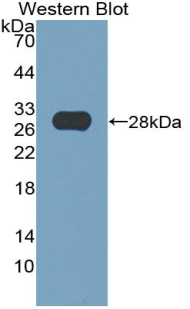 Polyclonal Antibody to Thyroid Peroxidase (TPO)