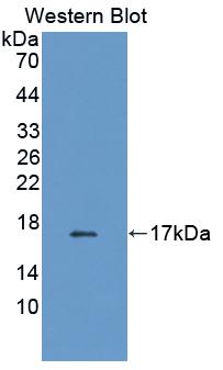 Polyclonal Antibody to Fatty Acid Binding Protein 2, Intestinal (FABP2)