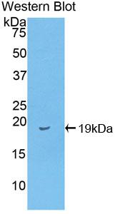 Polyclonal Antibody to Fatty Acid Binding Protein 2, Intestinal (FABP2)