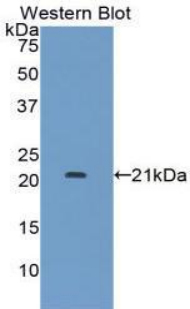 Polyclonal Antibody to Leukemia Inhibitory Factor Receptor (LIFR)