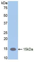 Polyclonal Antibody to Leukemia Inhibitory Factor Receptor (LIFR)