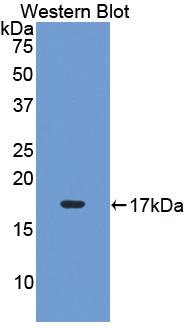 Polyclonal Antibody to Leukemia Inhibitory Factor Receptor (LIFR)