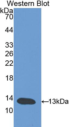 Polyclonal Antibody to Leukemia Inhibitory Factor Receptor (LIFR)