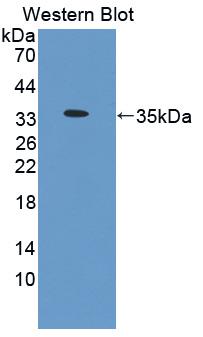 Polyclonal Antibody to Interleukin 1 Beta (IL1b)