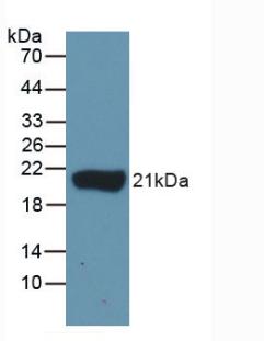 Polyclonal Antibody to Interleukin 1 Beta (IL1b)