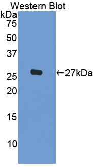 Polyclonal Antibody to Interleukin 1 Beta (IL1b)