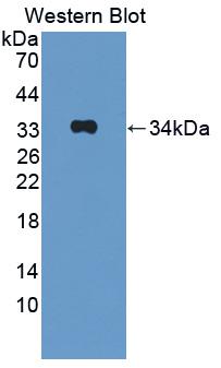 Polyclonal Antibody to Interleukin 1 Beta (IL1b)