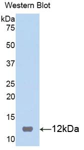 Polyclonal Antibody to S100 Calcium Binding Protein B (S100B)