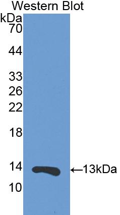 Polyclonal Antibody to S100 Calcium Binding Protein A11 (S100A11)