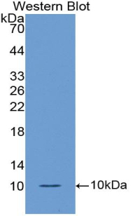 Polyclonal Antibody to Collagen Type II (COL2)