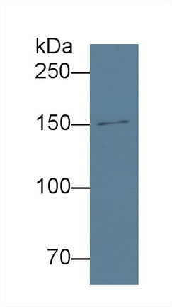 Polyclonal Antibody to Procollagen III N-Terminal Propeptide (PIIINP)