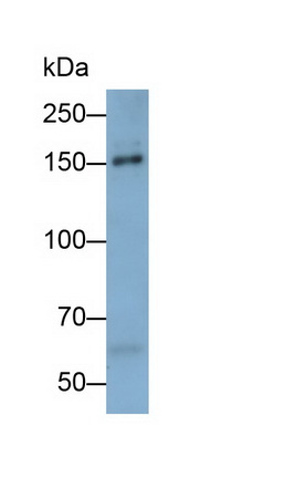 Polyclonal Antibody to Procollagen III N-Terminal Propeptide (PIIINP)