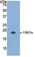 Polyclonal Antibody to Phospholipase A2 Activating Protein (PLAP)