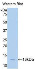 Polyclonal Antibody to Phospholipase A2 Activating Protein (PLAP)