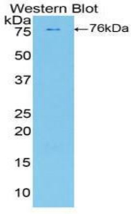 Polyclonal Antibody to Phospholipase A2 Activating Protein (PLAP)