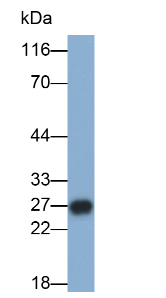 Polyclonal Antibody to Aquaporin 1 (AQP1)