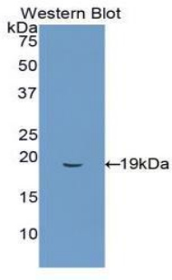 FITC-Linked Polyclonal Antibody to Heme Oxygenase 1 (HO1)