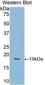 Polyclonal Antibody to Heme Oxygenase 1 (HO1)