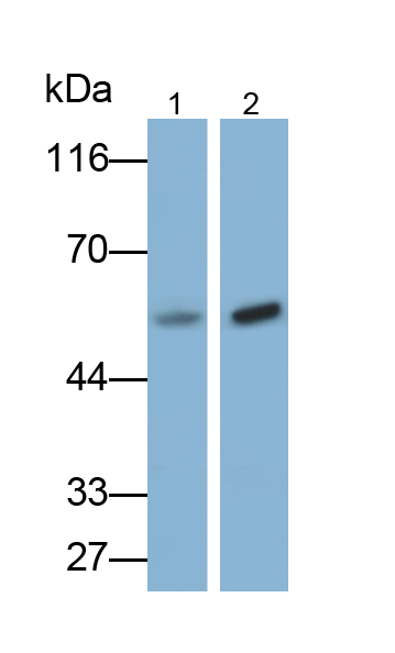 Polyclonal Antibody to Pyruvate kinase isozymes M2 (PKM2)