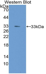 Polyclonal Antibody to Heme Oxygenase 2, Decycling (HO2)