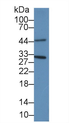 PAA591Hu01.jpg